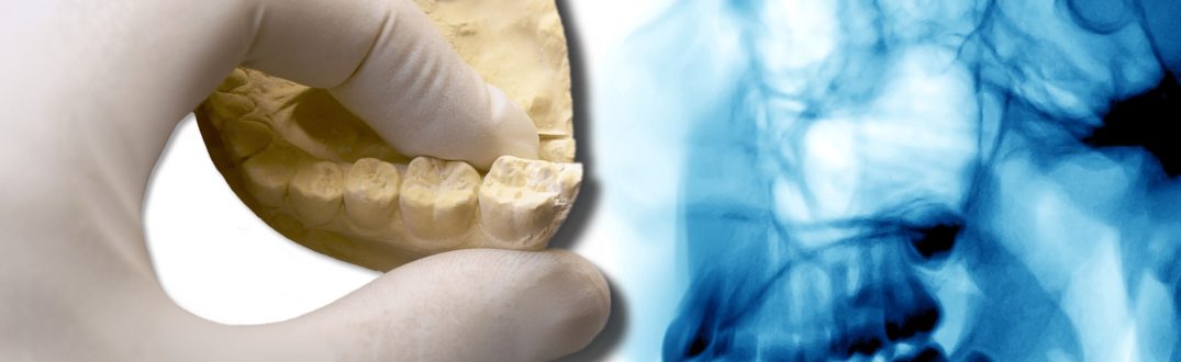 Stożkowa tomografia zębów - zalety diagnostyki 3D