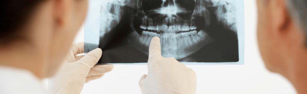 Dawka promieniowania w badaniu CBCT zęba