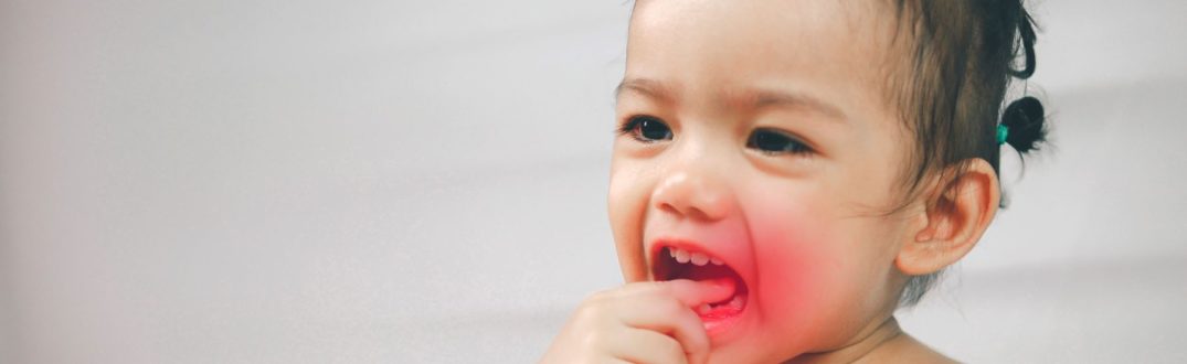 ból zęba u dziecka