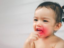 ból zęba u dziecka