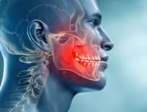 zanik kości szczęki